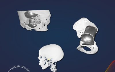 Contract Manufacturing for Medical Devices